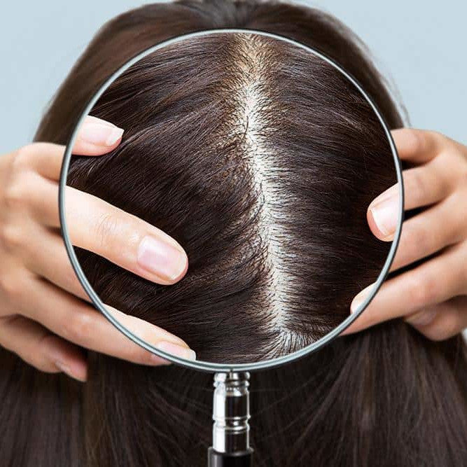 Příčiny vypadávání vlasů